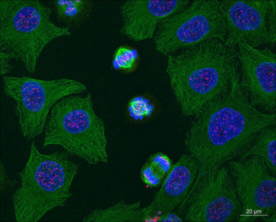 Mitosis qué es