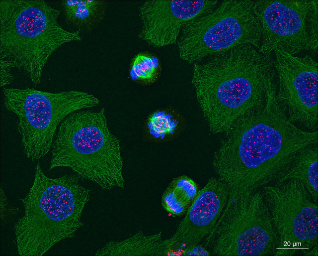 Mitosis Qué Es